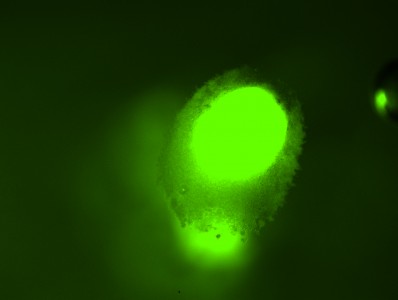 E. coli bacteria_picture